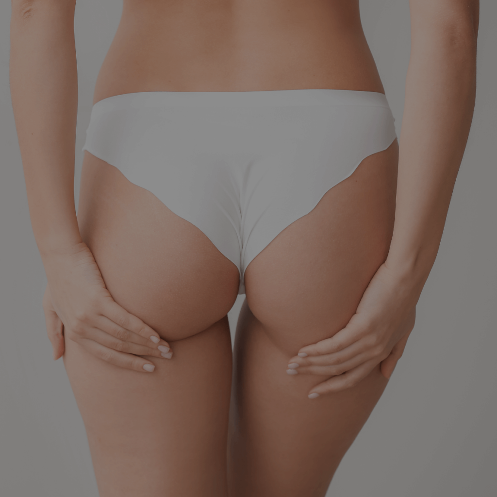 Glutei, Aori Medical Beauty Clinic Varese