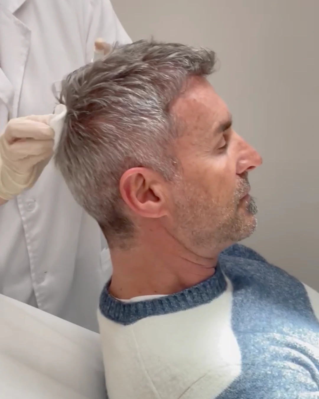 foto trattamento PRP presso Aori Medical Beauty Clinic