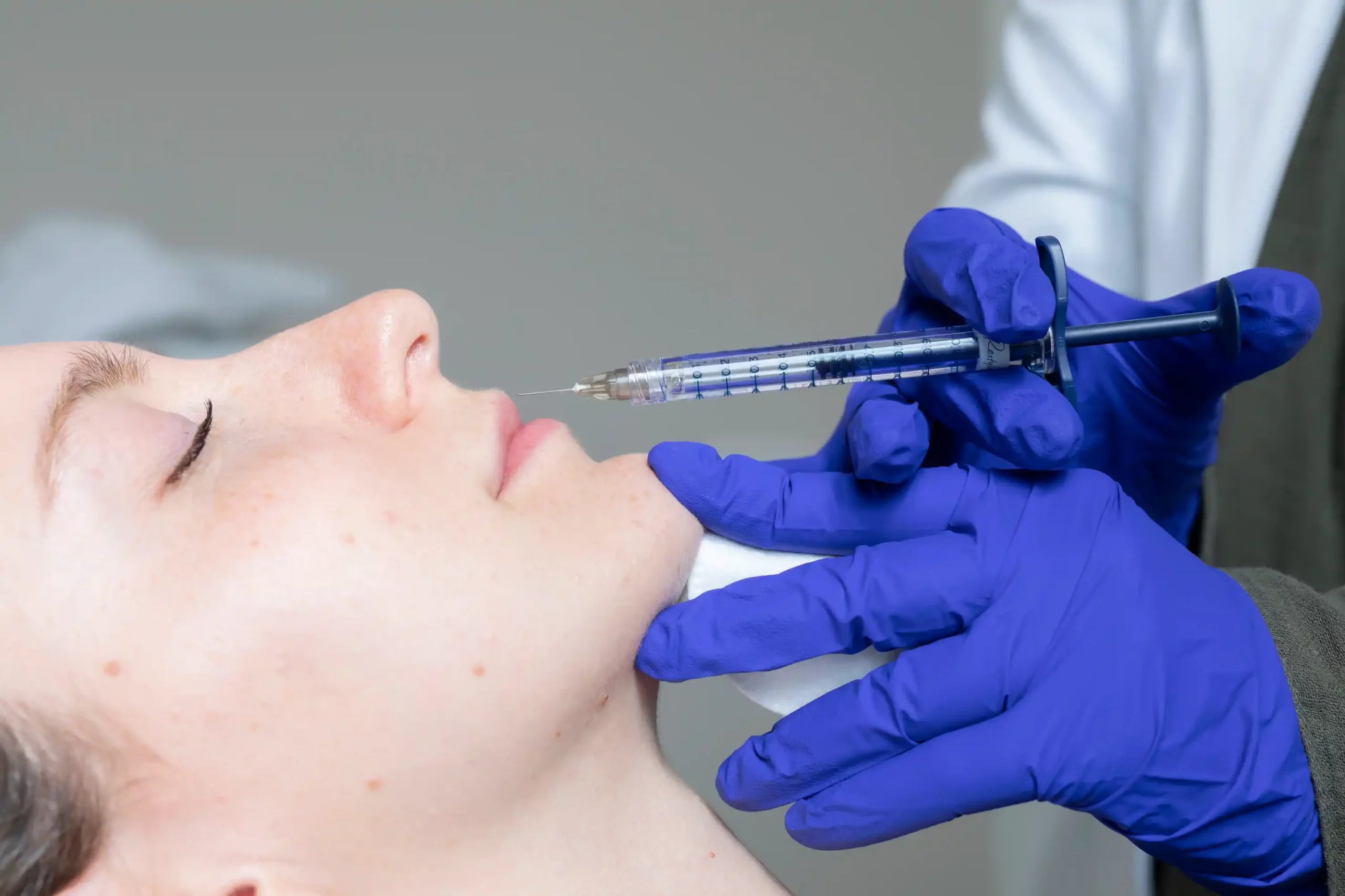 Filler labbra presso Aori Medical Beauty Clinic di Varese