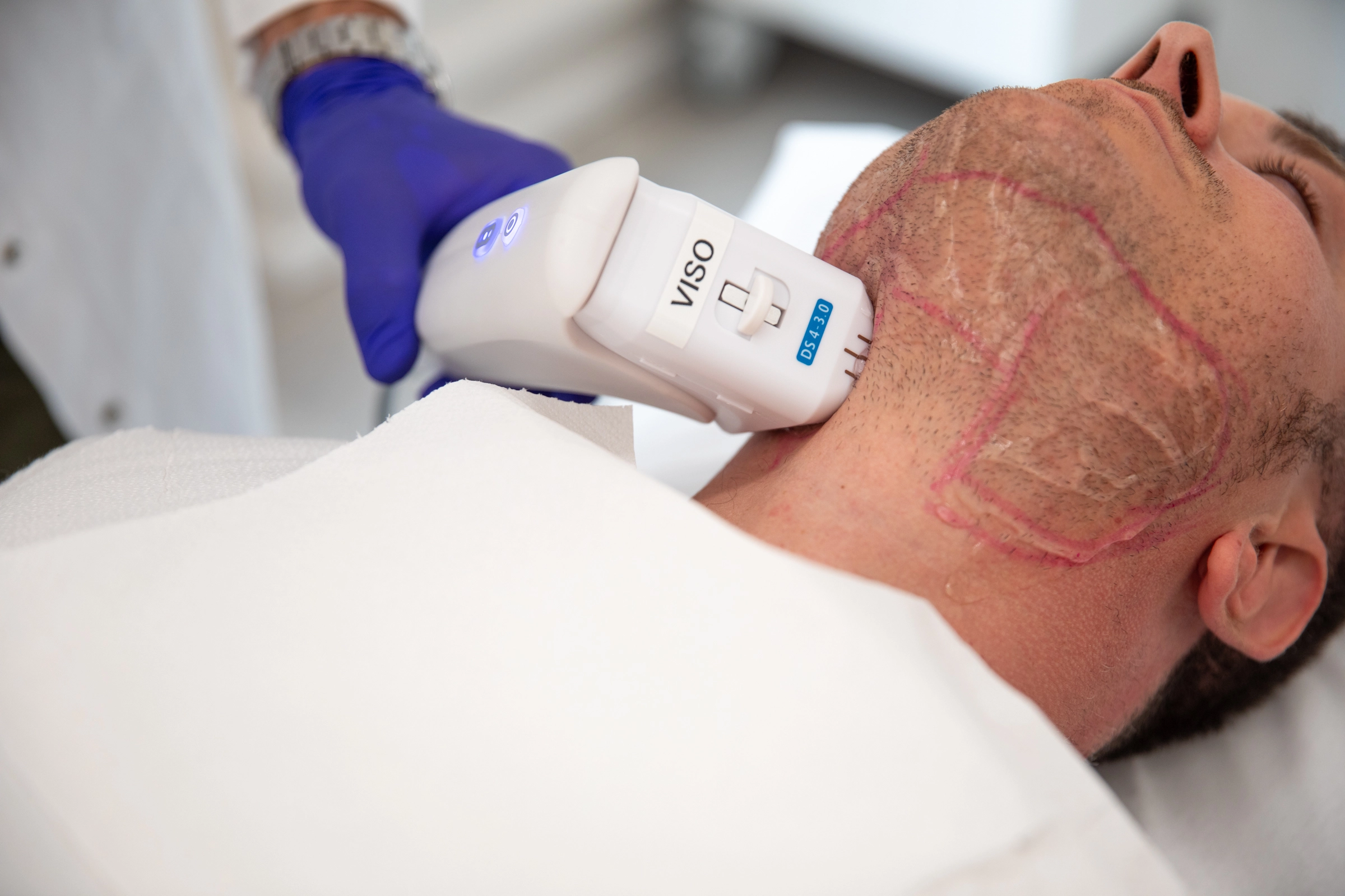 Trattamenti collo Aori Medical Beauty Clinic Varese